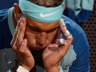 Nie som zranený, ja so zranením žijem, vraví Nadal. Chce stihnúť Roland Garros